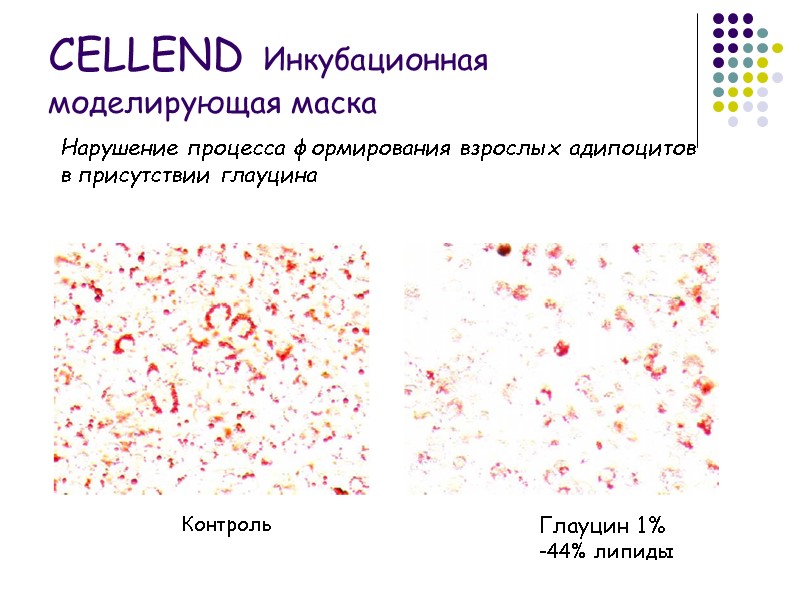 Нарушение процесса формирования взрослых адипоцитов  в присутствии глауцина Контроль Глауцин 1% -44% липиды
